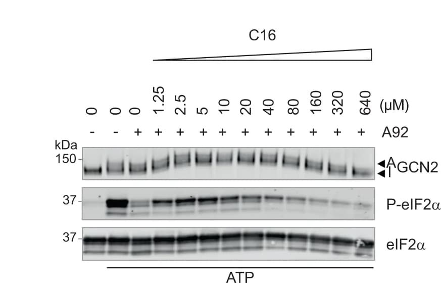 Open access visualization of Gel, Immunoblots, In Vitro Kinase Reaction, ATP, A92