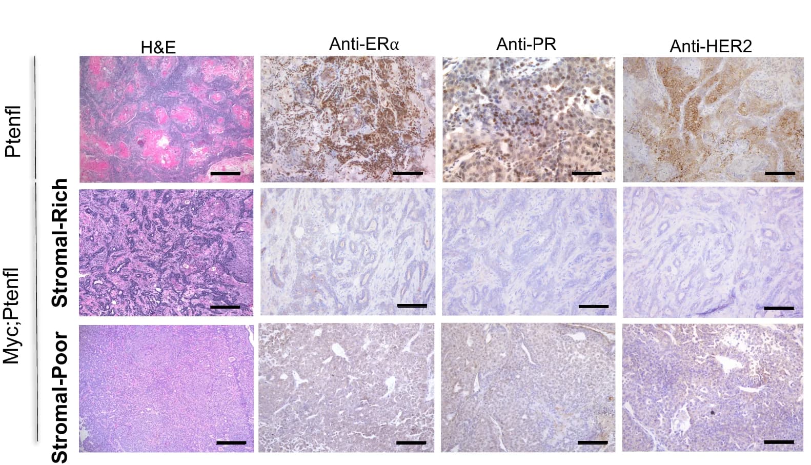 Open access visualization of Microscopy, H&E Staining, Myc;Ptenfl Tumors, Immunohistochemistry, PR
