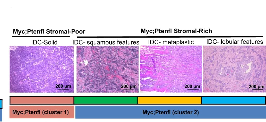 Open access visualization of Microscopy, Tumor Histology, Squamous, Metaplastic, Lobular Features