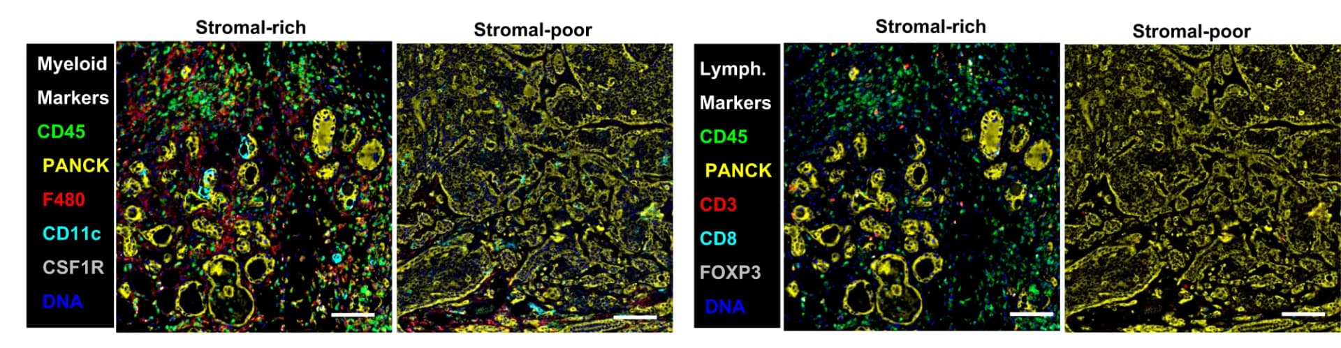 Open access visualization of Microscopy, Multiplex Immunohistochemistry, Stromal-rich Tumors, Stromal-poor Tumors, Myeloid Markers