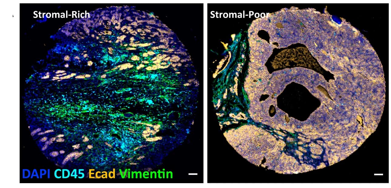 Open access visualization of Microscopy, CyCIF, Tissue Microarray, Stromal-rich, Stromal-poor