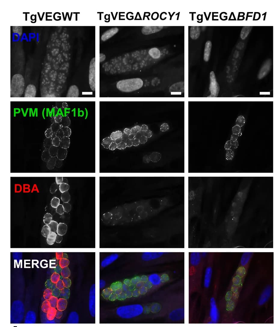 Open access visualization of Microscopy, T. gondii VEG-containing vacuoles, Alkaline pH stress, DAPI staining, Parasitophorous vacuole membrane