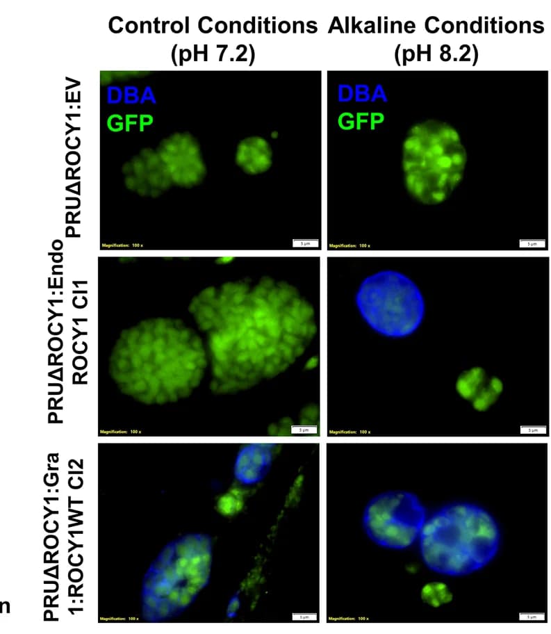 Open access visualization of Microscopy, TgPRUΔ ROCY1, Endogenous Promoter, Overexpression Promoter, Control Conditions