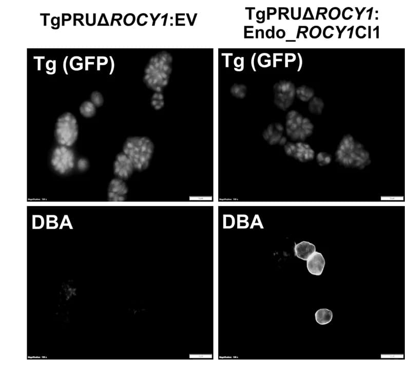 Open access visualization of Microscopy, Spontaneously Forming Cysts, DBA, Endogenous Promoter, TgPRUΔROCY1