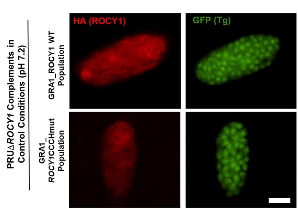 Open access visualization of Microscopy, Vacuoles, PRUΔ ROCY1 parasites, Wild type, CCCH mutant