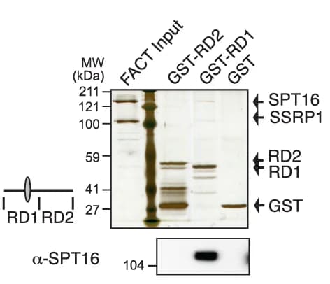 Open access visualization of Gel, Silver Staining, Affinity Purification, GST-Tagged, MLL RD1