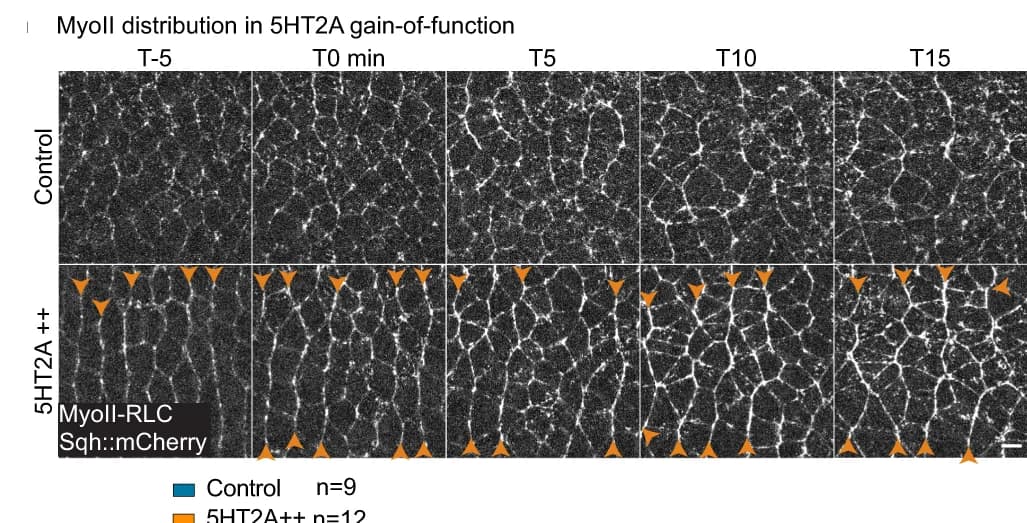 Open access visualization of Microscopy, MyoII, Distribution, 5HT2A, Overexpression