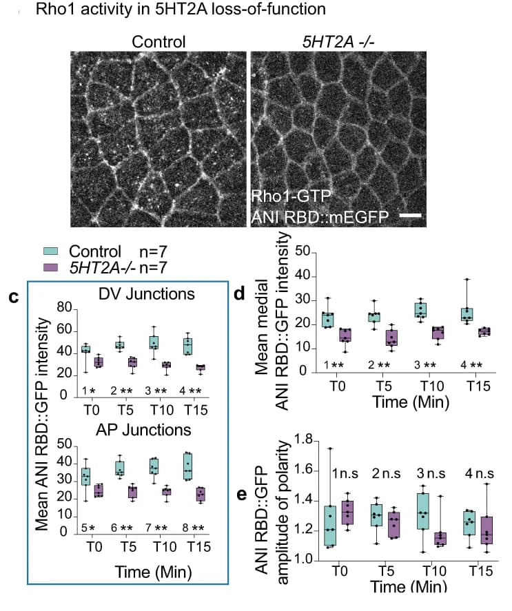 Open access visualization of Box Plot, Microscopy, Rho1 activity, 5HT2A, Rho1-GTP