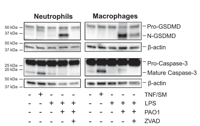 Open access visualization of Gel, Caspase-3, GSDMD, GSDME, Cell Lysates