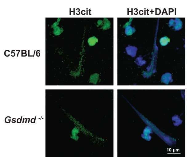 Open access visualization of Microscopy, NETosis, C57BL/6 Mice, Gsdme -/- Mice