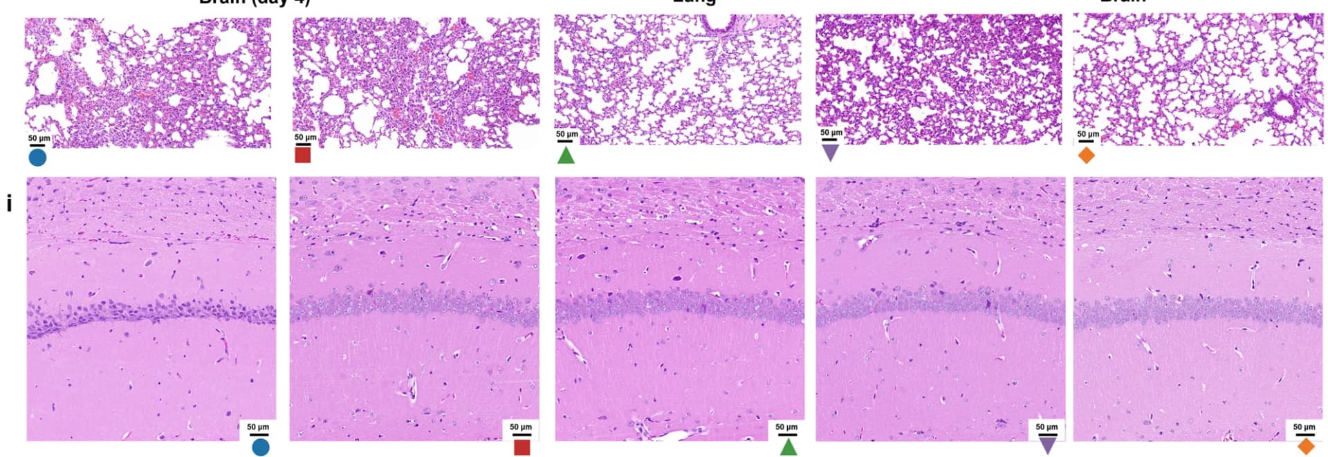Open access visualization of Microscopy, H&E Staining, Lungs, Post-Infection Day 4, Histopathology