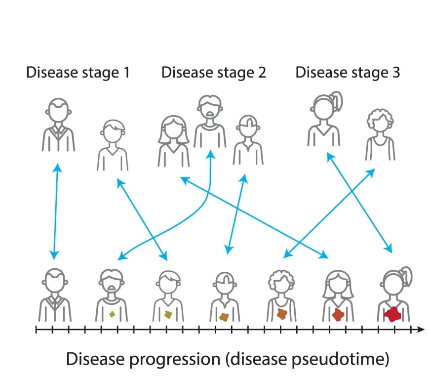 Open access visualization of Workflow, Flowchart, Disease Progression, Patient Subtyping, Patient Stratification