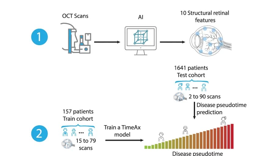 Open access visualization of Workflow, AMD dynamics, TimeAx modeling, Disease pseudotime, OCT scans