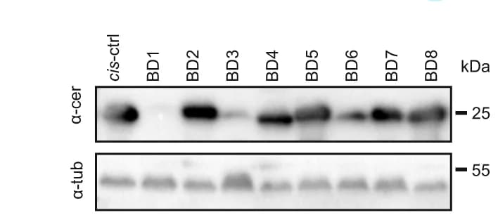 Open access visualization of Gel, Western blots, Transfected Cells, Anti-cerulean antibody, Anti-β-tubulin antibody