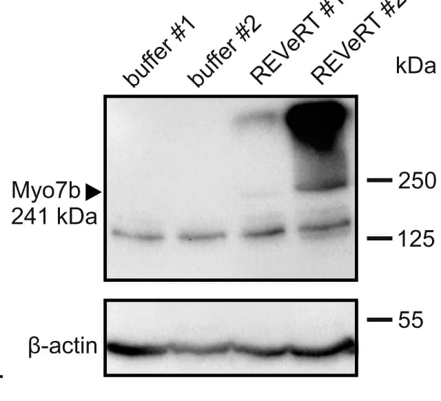 Open access visualization of Gel, Western Blot, Retinas, REVeRT AAVs