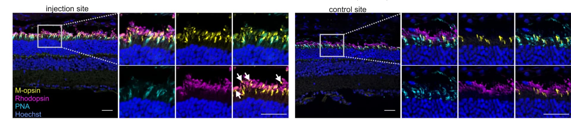 Open access visualization of Microscopy, Immunostainings, Retinal cryosections, Rho P23H/+ mice, REVeRT(3xg)