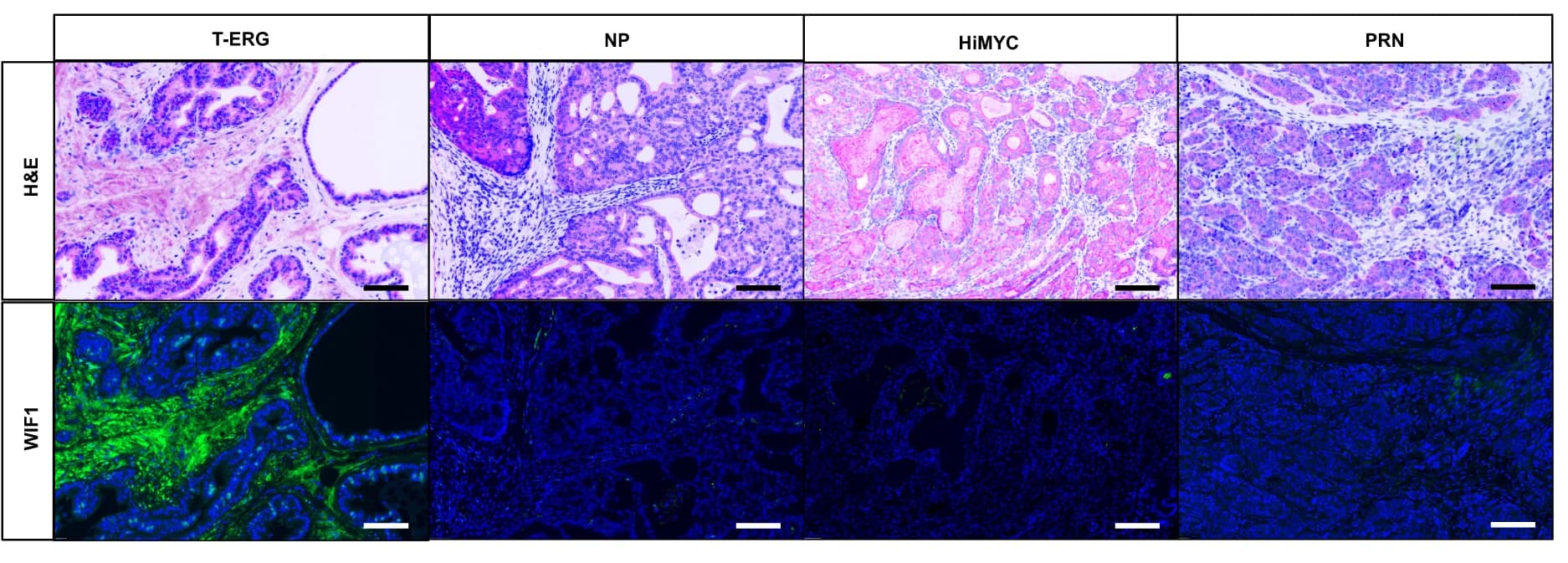 Open access visualization of Microscopy, WIF1 expression, Tumor, Mouse Models, Images