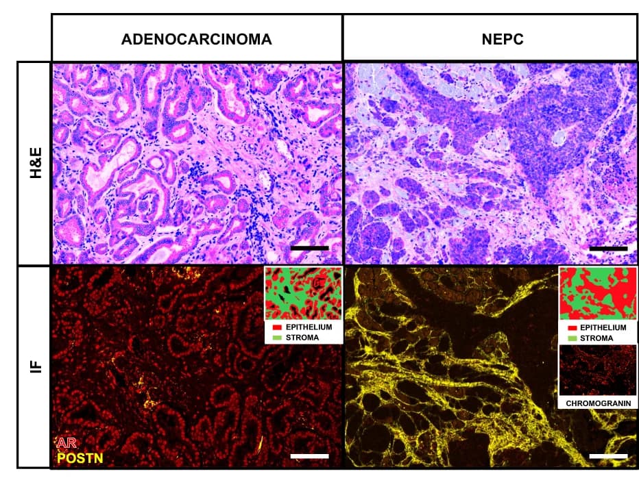 Open access visualization of Microscopy, Multiplexed Staining, Periostin, AR, Chromogranin