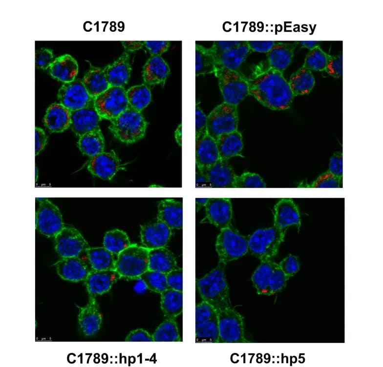 Open access visualization of Microscopy, Confocal Microscopy, Bacterial Survival, Macrophages, F-actin