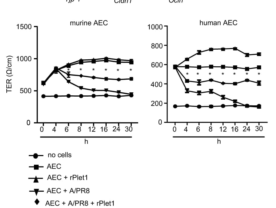 Open access visualization of Line Plot, Error Bars, ZO-1, AEC, IAV