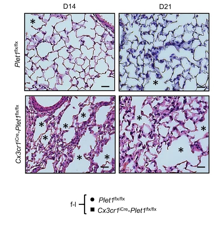Open access visualization of Microscopy, Lung Sections, IAV-infected, Plet1 flx/flx Mice, Cx3cr1 iCre -Plet1 flx/flx Mice