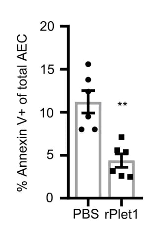 Open access visualization of Bar Plot, Error Bars, Scatter Plot, Annexin V, AECs