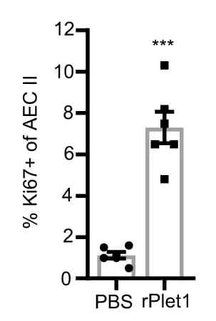 Open access visualization of Bar Plot, Error Bars, Ki67, AEC II, Proliferation