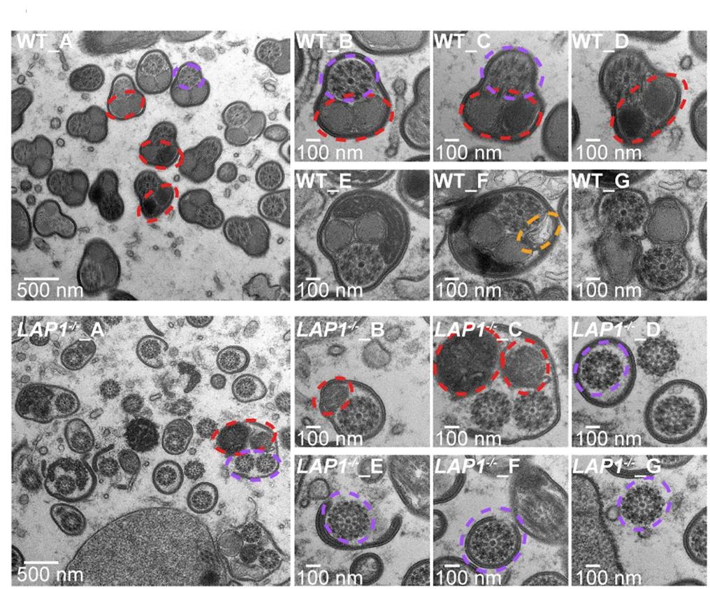 Open access visualization of Microscopy, TEM, Spermatozoa, Mosquitoes, Mitochondrial Derivatives