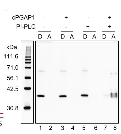 Open access visualization of Gel, Triton X-114, Phase Separation Assay, Detergent Phase, Aqueous Phase
