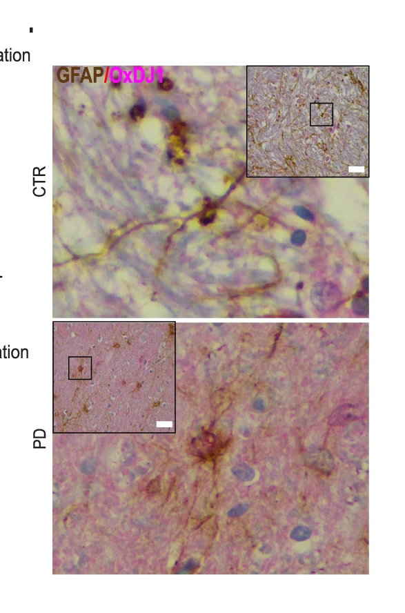 Open access visualization of Microscopy, Micrography, GFAP, Midbrain, Astrocytes