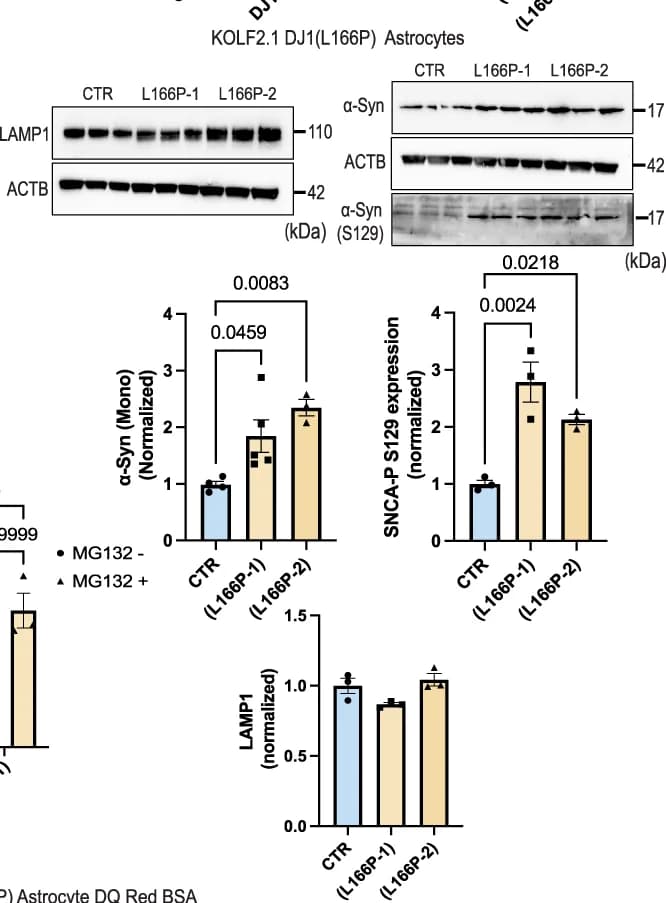 Open access visualization of Bar Plot, Error Bars, Gel, Immunoblots, LAMP1