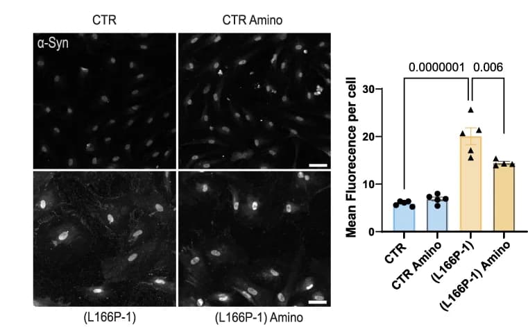 Open access visualization of Bar Plot, Error Bars, Microscopy, Alpha-synuclein, Astrocytes