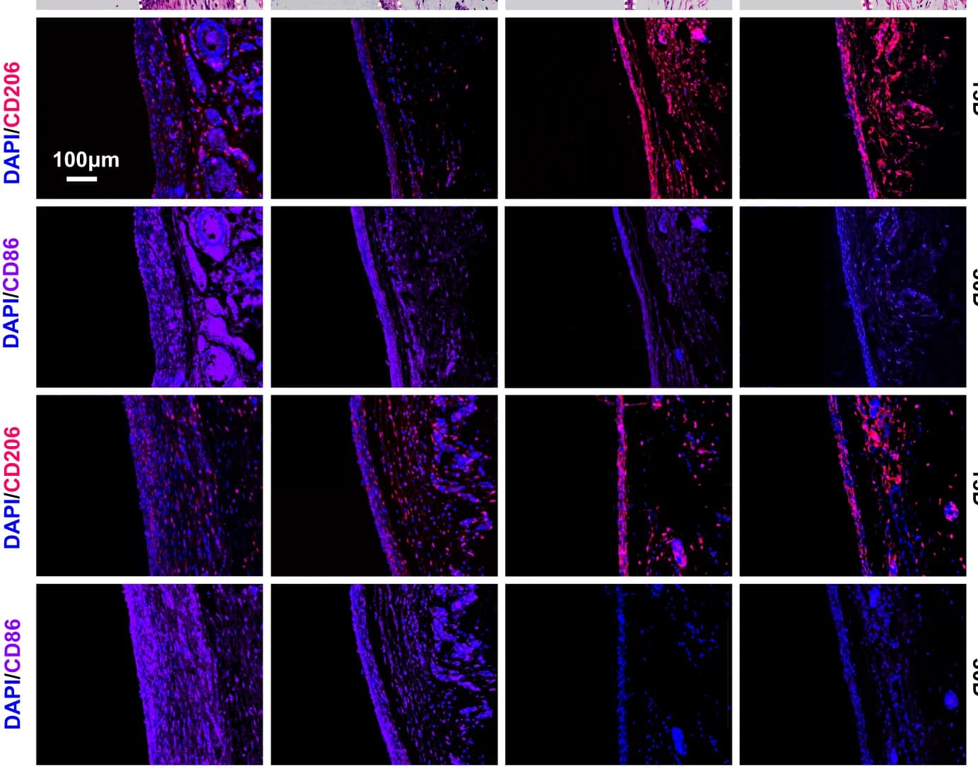 Open access visualization of Microscopy, Immunofluorescence, Macrophages, CD206, CD68
