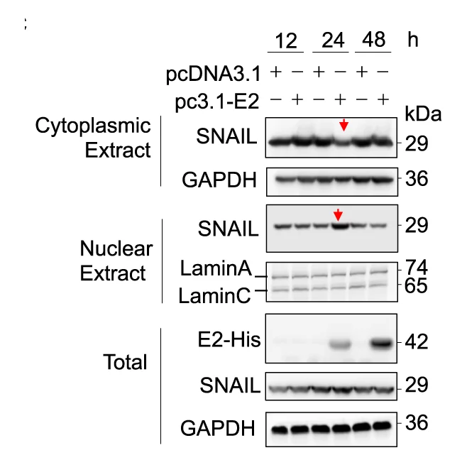 Open access visualization of Gel, Immunoblot, Huh7 Cells, HCV-E2, Subcellular Fraction