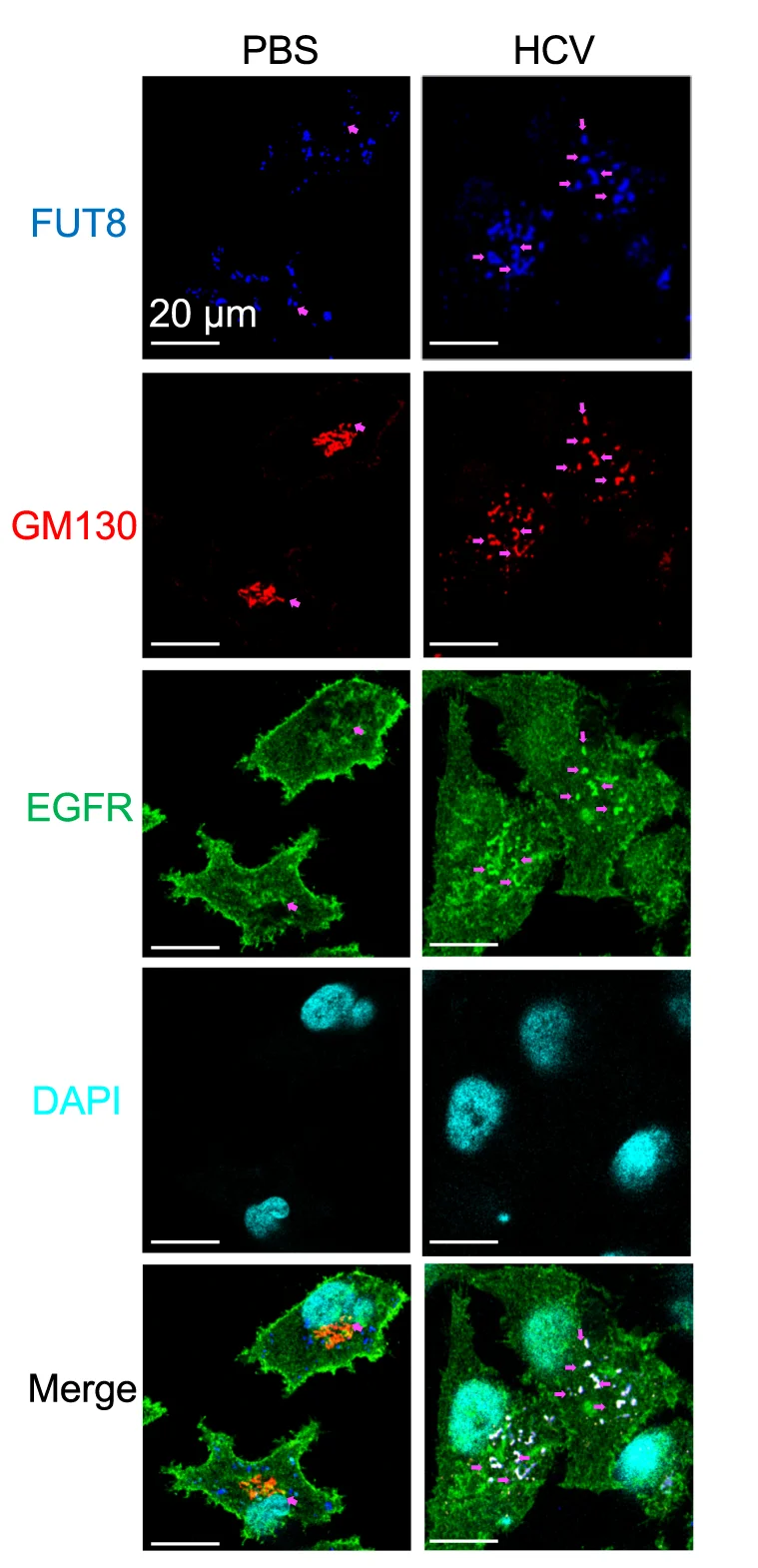 Open access visualization of Microscopy, Huh7 Cells, HCV Infection, EGFR, FUT8