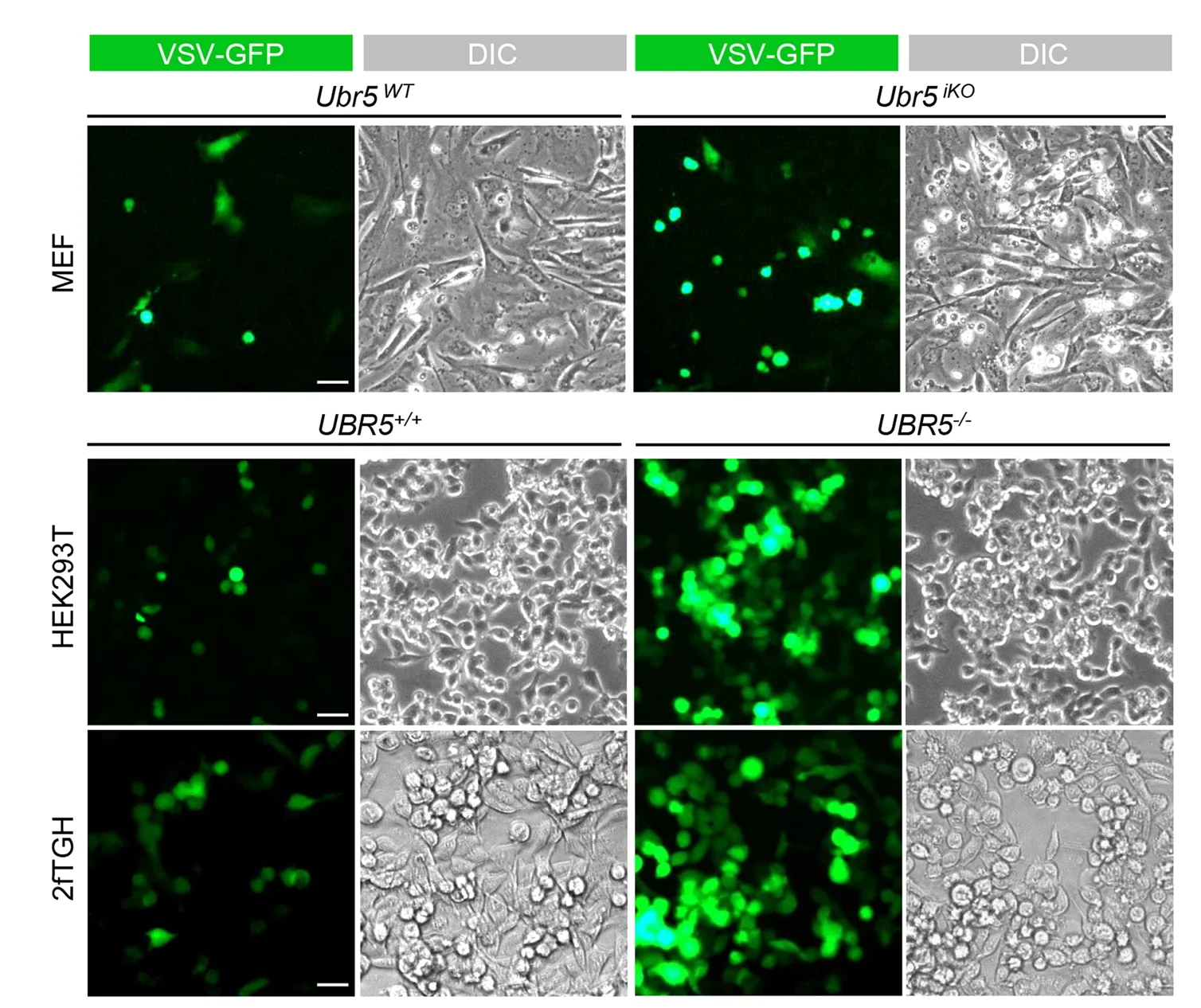 Open access visualization of Microscopy, Fluorescent Images, VSV-GFP, DIC, Cell Types