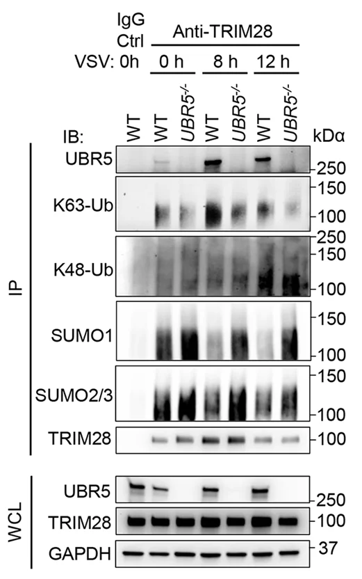 Open access visualization of Gel, HEK293T Cells, VSV Infection, TRIM28, Immunoprecipitation
