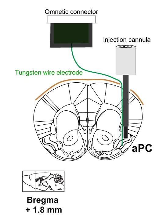 Open access visualization of Illustration, Implanted Device, Tungsten Wire Electrode, Local Injection Cannula, LFP Monitoring