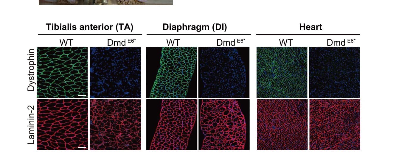 Open access visualization of Microscopy, Dystrophin, Laminin-2, Immunostaining, TA Muscle