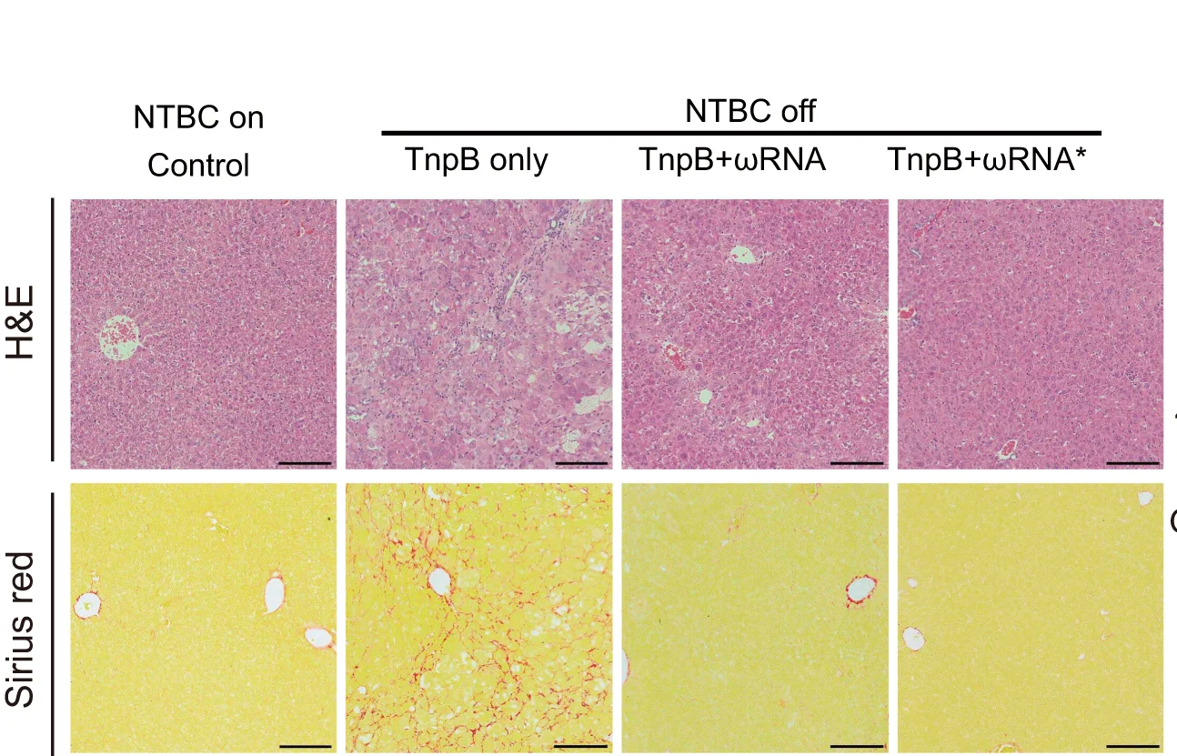 Open access visualization of Microscopy, Histology Analysis, H&E Staining, Sirius Red Staining, Mouse Liver