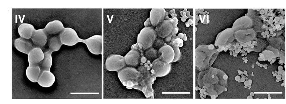 Open access visualization of Microscopy, SEM Images, MRSA, Phosphate Buffered Saline, CeO2