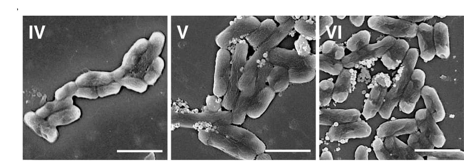 Open access visualization of Microscopy, SEM Images, E. Coli, Phosphate Buffered Saline, CeO2