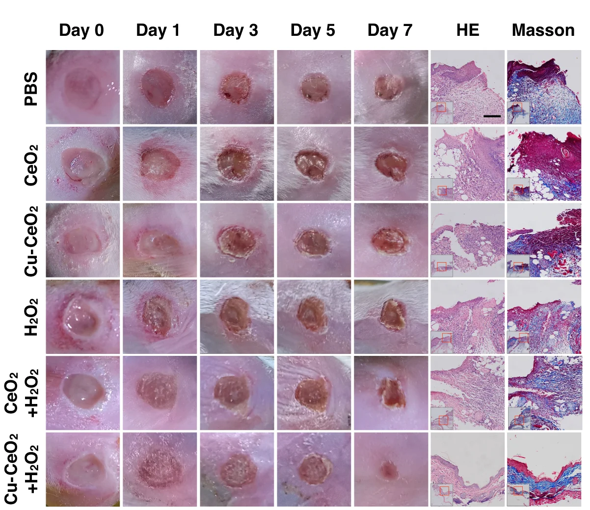 Open access visualization of Photo, Microscopy, Photographs, HE Staining, Masson Staining