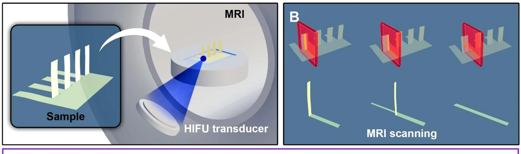 Open access visualization of Illustration, Workflow, MRgHIFU, Heating, PUU-PCL Device