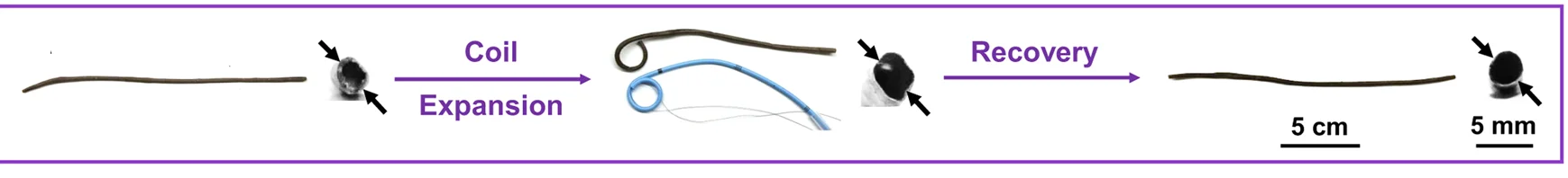 Open access visualization of Workflow, Flowchart, Illustration, Fe3O4 Nanoparticle, PUU-PCL Stent