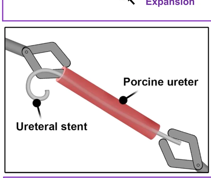 Open access visualization of Illustration, Ex Vivo Stent Removal, Porcine Ureter, J-shaped Coil, Renal Pelvis