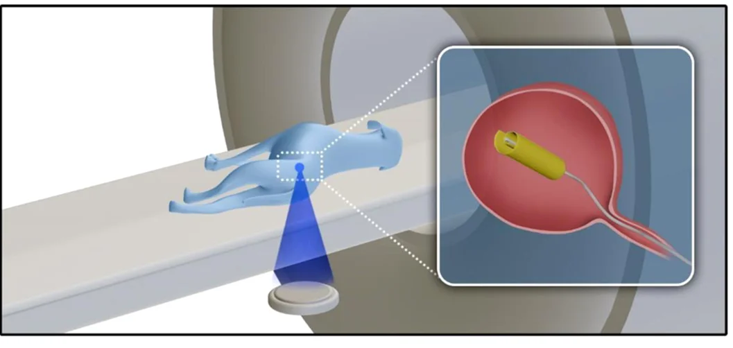 Open access visualization of Illustration, HIFU Heating, Flag-Shaped Device, Canine Bladder, Ureteroscopy