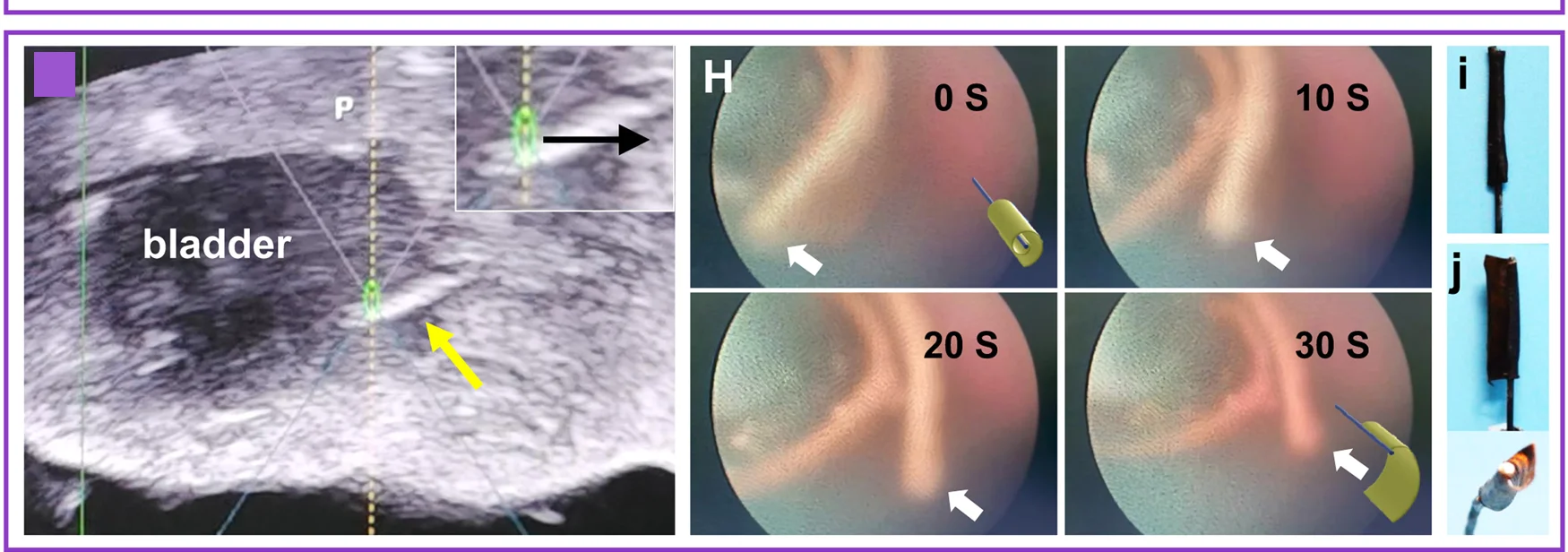 Open access visualization of Microscopy, Photo, Ultrasound Image, Fe3O4, PUU-PCL Device