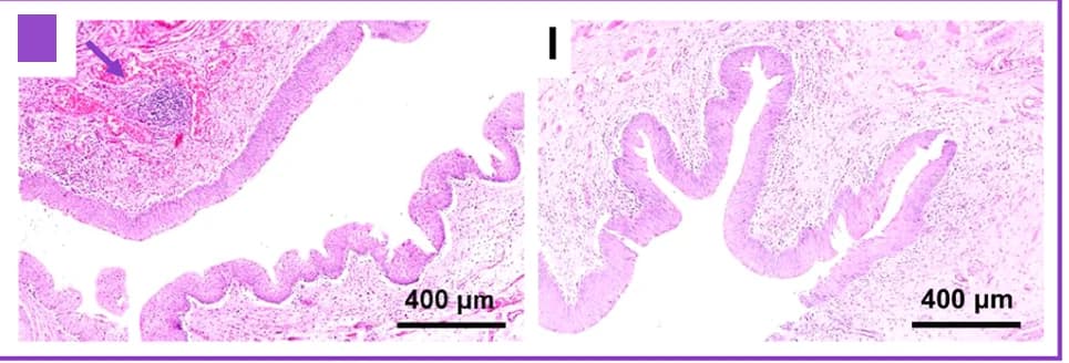 Open access visualization of Microscopy, H&E Staining, Bladder Neck, Internal Urethral Sphincter, Micro Bleeding