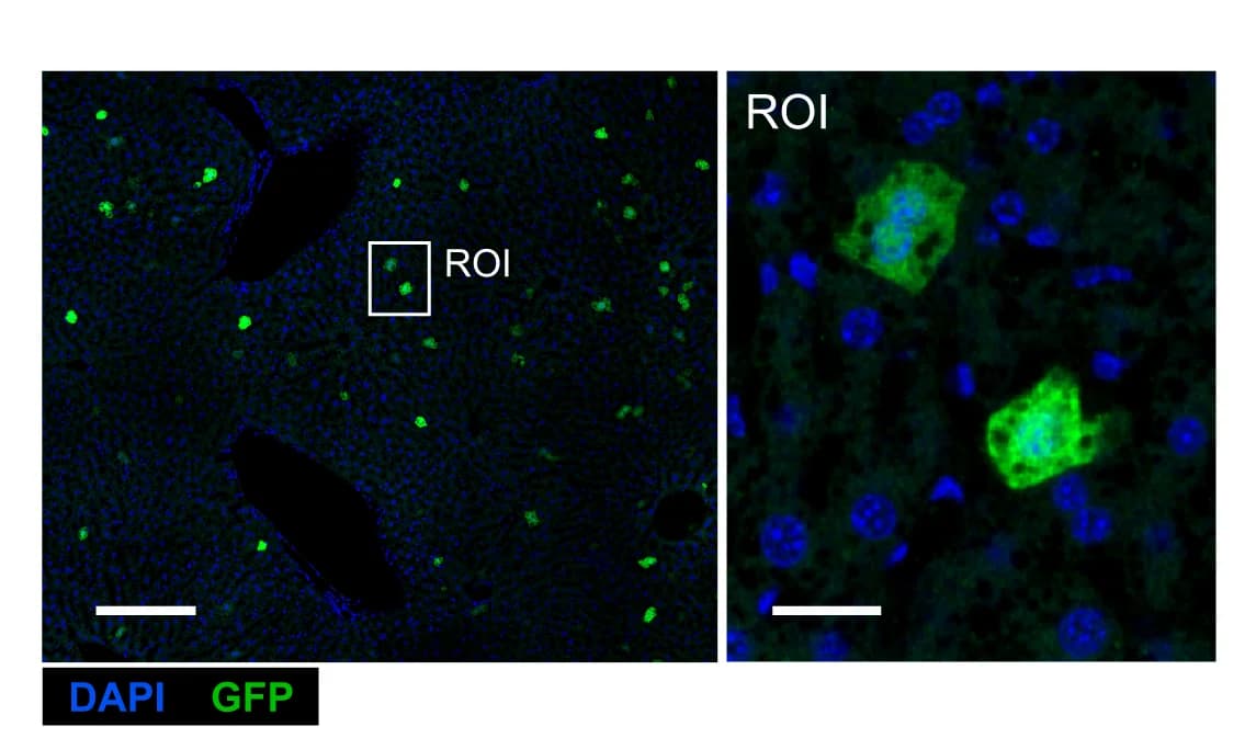 Open access visualization of Microscopy, Confocal Image, C57BL/6 Mouse, rAAV gB-Ag85b Treatment, GFP expressing Hepatocytes